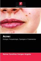 Acne: