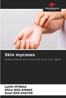 Skin Mycoses