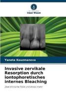 Invasive Zervikale Resorption Durch Iontophoretisches Internes Bleaching