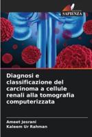 Diagnosi E Classificazione Del Carcinoma a Cellule Renali Alla Tomografia Computerizzata