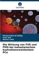 Die Wirkung Von FXR Und FMD Bei Metastasiertem Kastrationsresistentem PCa