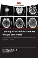 Techniques D'amélioration Des Images Cérébrales