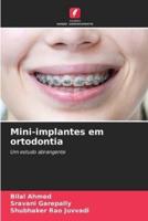 Mini-Implantes Em Ortodontia