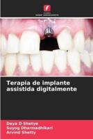 Terapia De Implante Assistida Digitalmente