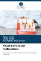 Attachments in Der Implantologie