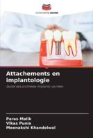 Attachements En Implantologie
