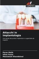 Attacchi in Implantologia