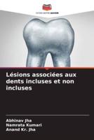 Lésions Associées Aux Dents Incluses Et Non Incluses