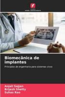 Biomecânica De Implantes