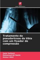 Tratamento Da Pseudartrose Da Tíbia Com Um Fixador De Compressão