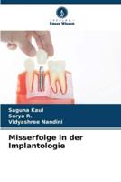 Misserfolge in Der Implantologie