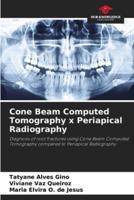 Cone Beam Computed Tomography X Periapical Radiography