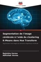 Segmentation De L'image Cérébrale À L'aide Du Clustering K-Means Dans Hue Transform