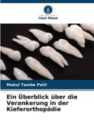 Ein Überblick Über Die Verankerung in Der Kieferorthopädie