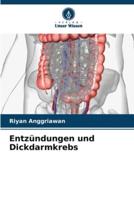 Entzündungen Und Dickdarmkrebs