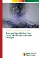 Tomografia Multislice Com Protocolo De Baixa Dose De Radiação