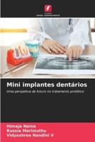 Mini Implantes Dentários