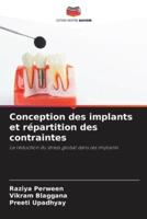 Conception Des Implants Et Répartition Des Contraintes