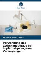 Verwendung Des Zwischenaufbaus Bei Implantatgetragenen Versorgungen