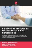 Ligadura Do Prolapso Da Mucosa Rectal E Das Hemorróidas