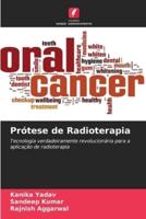 Prótese De Radioterapia