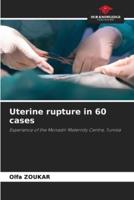Uterine Rupture in 60 Cases