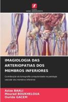 Imagiologia Das Arteriopatias DOS Membros Inferiores