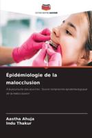 Épidémiologie De La Malocclusion