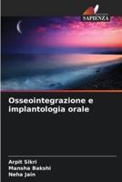 Osseointegrazione E Implantologia Orale