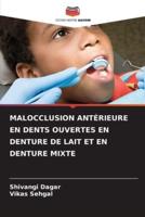 Malocclusion Antérieure En Dents Ouvertes En Denture De Lait Et En Denture Mixte