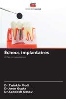 Échecs Implantaires