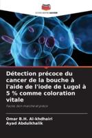 Détection Précoce Du Cancer De La Bouche À L'aide De L'iode De Lugol À 5 % Comme Coloration Vitale