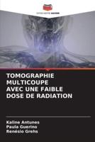 Tomographie Multicoupe Avec Une Faible Dose De Radiation