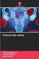 Cancro Da Vulva