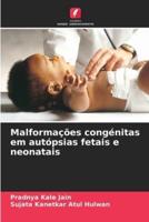 Malformações Congénitas Em Autópsias Fetais E Neonatais