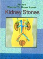 All You Wanted to Know About Kidney Stones