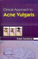 Clinical Approach to Acne Vulgaris