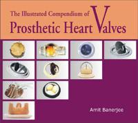 The Illustrated Compendium of Prosthetic Heart Valves