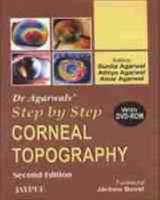 Dr Agarwal's Step by Step¬ Corneal Topography