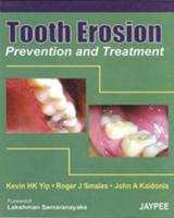 Tooth Erosion Prevention and Treatment
