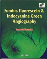 Fundus Fluorescien and Indocyanine Green Angiography