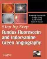 Step by Step¬ Fundus Fluorescein and Indocyanine Green Angiography
