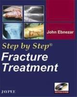 Step by Step: Fracture Treatment