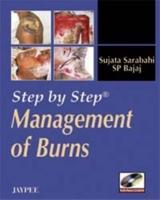 Step by Step: Management of Burns