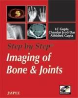 Step by Step: Imaging of Bone and Joints