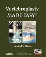 Vertebroplasty Made Easy