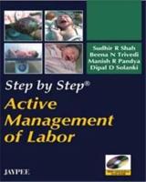 Step by Step: Active Management of Labor