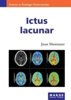 Ictus Lacunar