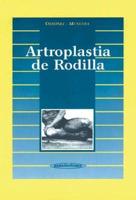 Artroplastica de Rodilla