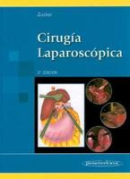 Cirugia Laparoscopica